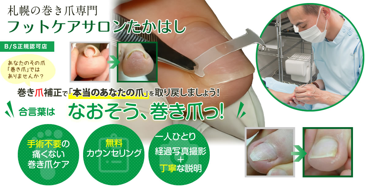 KKK様専用。巻き爪補正ベーシックコース 日本フットケア普及